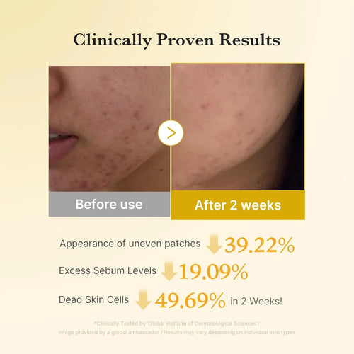 Aurucia™ Kojic Acid Turmeric Duo