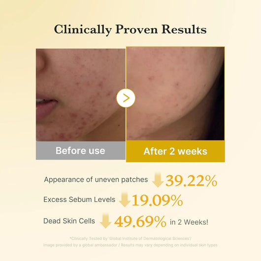Aurucia™ Kojic Acid Turmeric Duo
