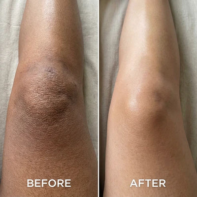 Aurucia™ Brightening Peel Shot Spray