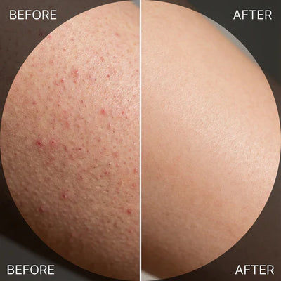 Aurucia™ Brightening Peel Shot Spray