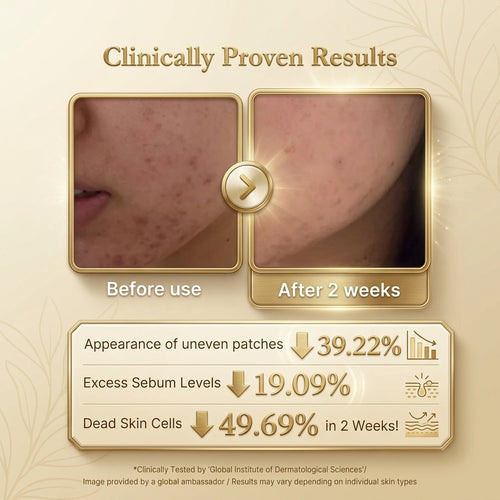 Aurucia™ Kojic Acid Turmeric Duo