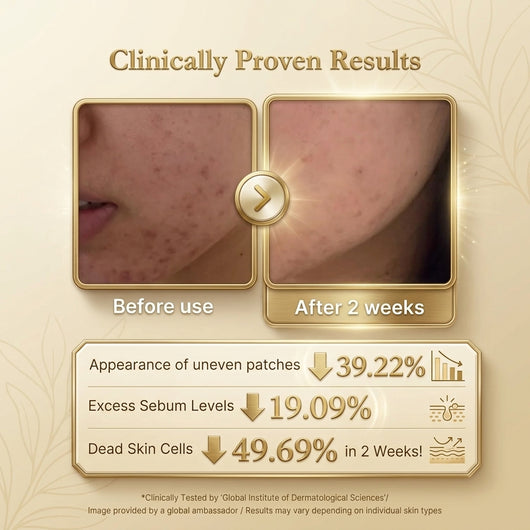 Aurucia™ Kojic Acid Turmeric Duo